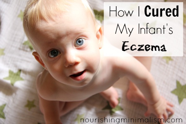 How I Cured My Infants Eczema (with Pictures)